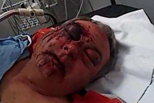 Police appeal after brutal attack on taxi driver over ‘vomit in cab’ row