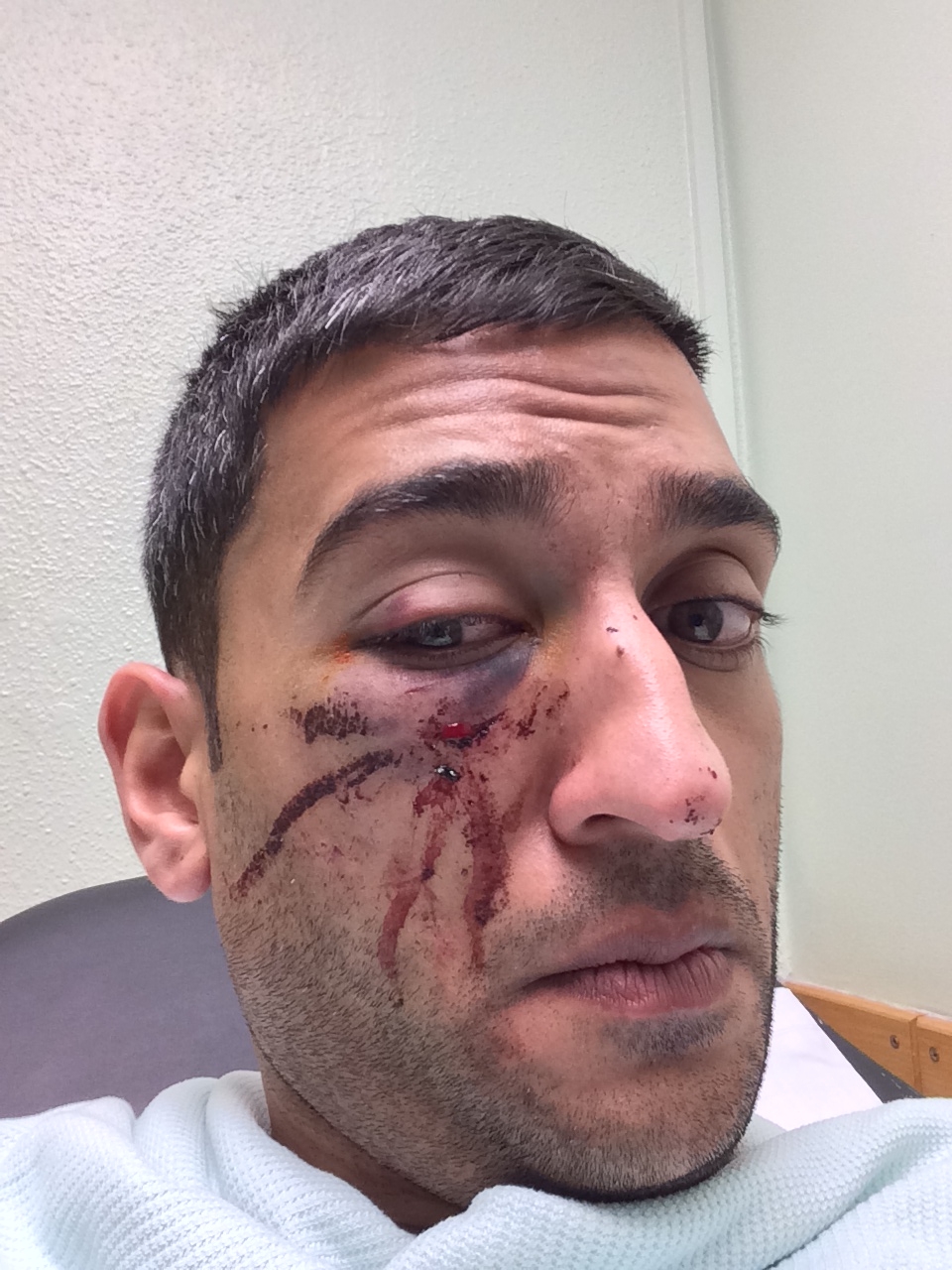 Images released following serious asault in Camden
