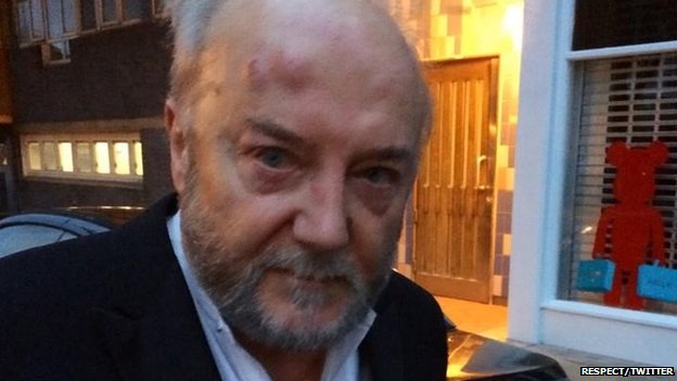 George Galloway taken to hospital after London street attack