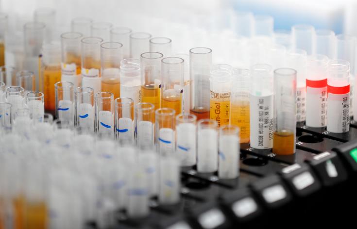 Cyprus authorities announce five new infected cases in Limassol after completing 990 tests on Friday