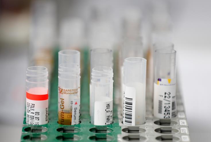 Authorities detect 15 new COVID-19 cases in Cyprus,10 of them in Limassol