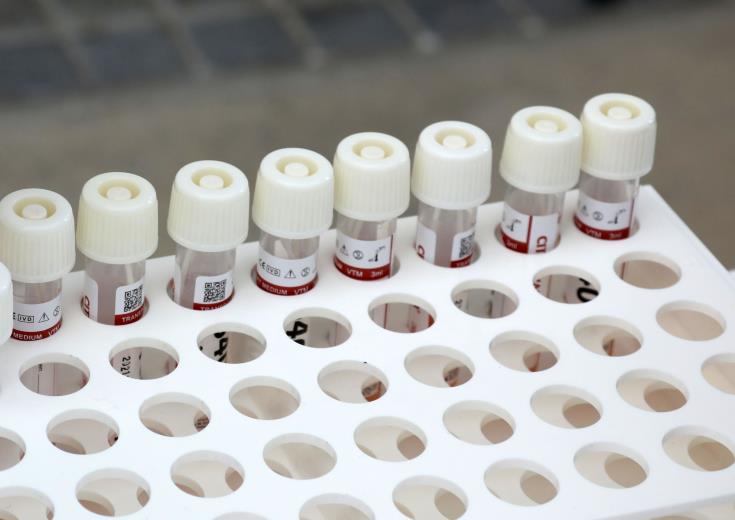 10,000 residents in Broxbourne urged to get tested amid isolated cases of new COVID-19 variant