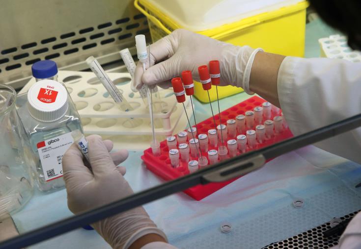 One dead and 577 new COVID-19 cases announced in Cyprus