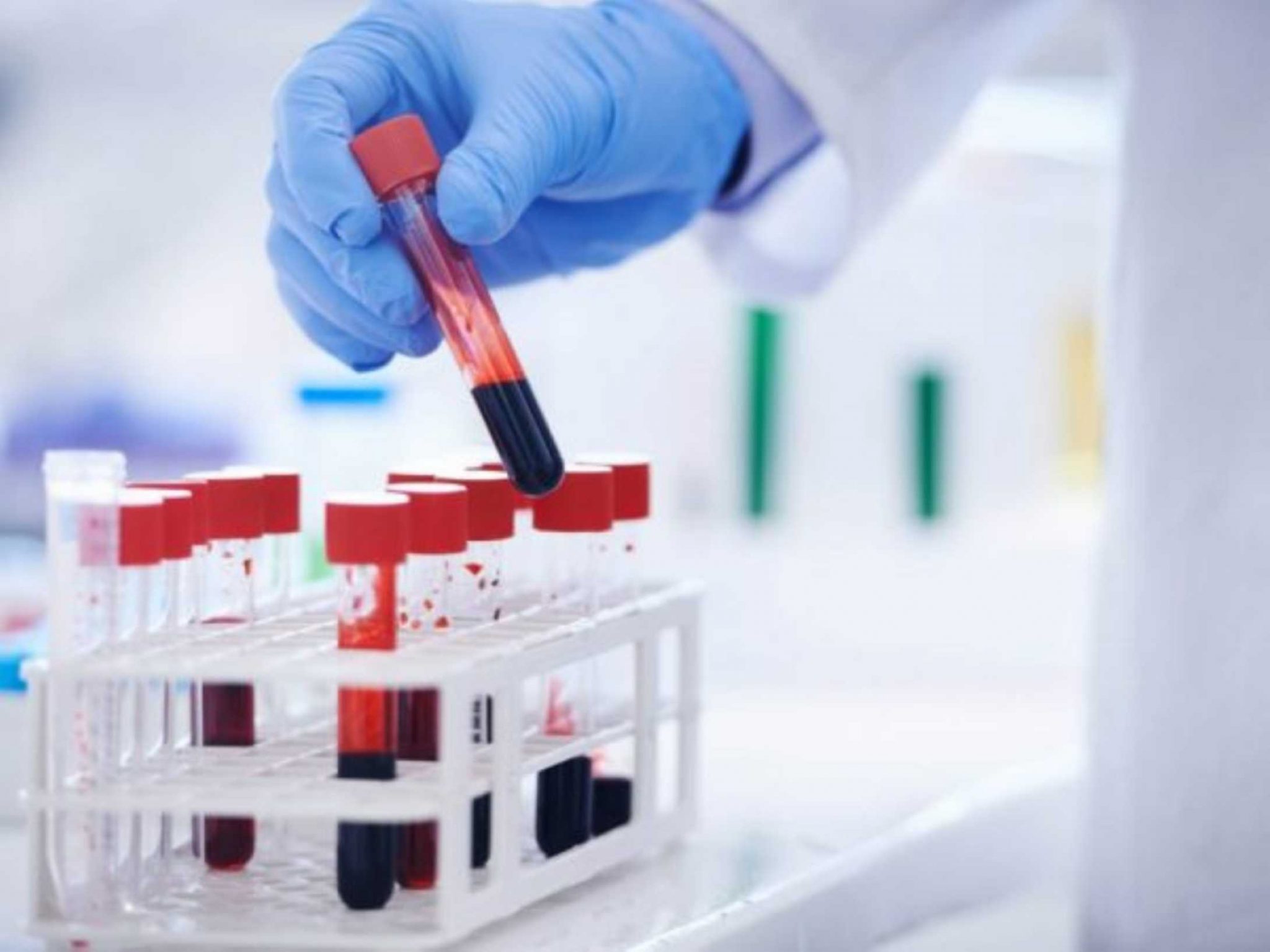 NHS begins world’s largest trial of blood test for 50 types of cancer